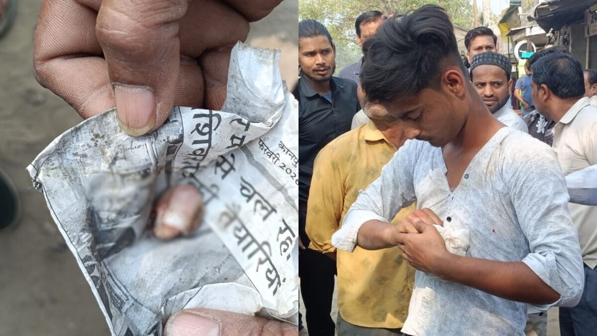 सिगरेट के 7 रुपये मांगने पर हैवानियत... युवक ने दुकानदार की उंगली दांत से काटकर किया अलग, जमीन पर गिरा टुकड़ा