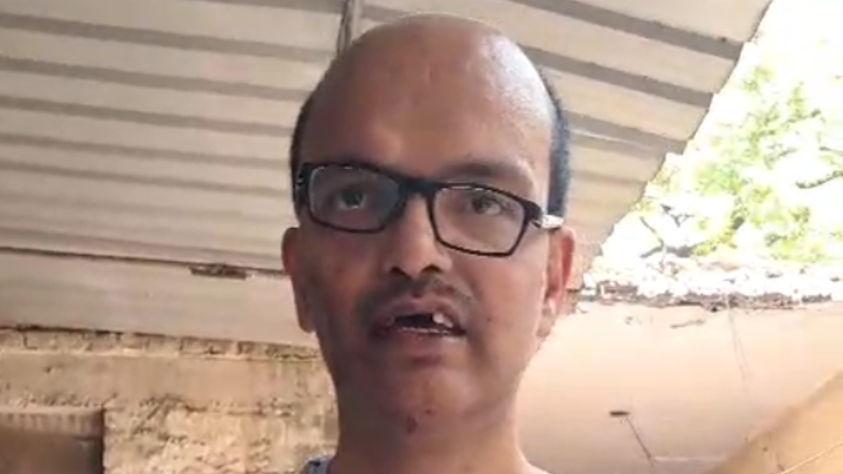 टूटी सड़क का मजाक बनाया तो पीटा, 3 दांत तोड़े, टूटे दांत हाथ में देकर बोला- 'लो बन गई सड़क'