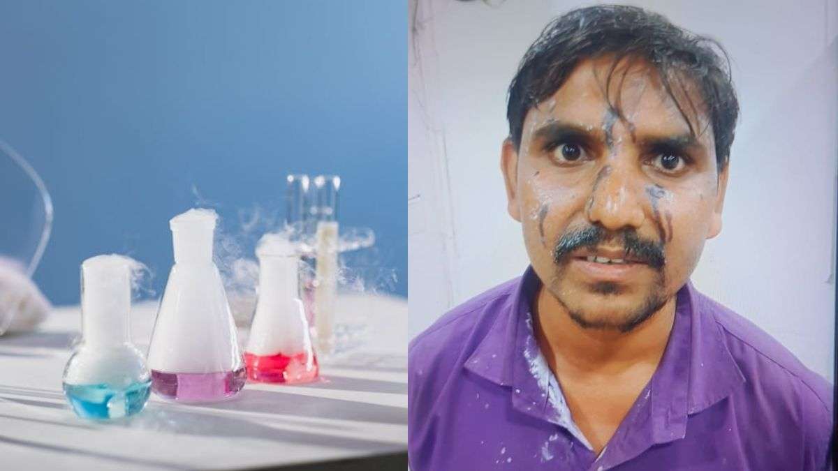 महज 600 रुपये की उधारी के चक्कर में 'जंग'! मजदूरों ने एक-दूसरे पर फेंका तेजाब, बुरी तरह झुलसे