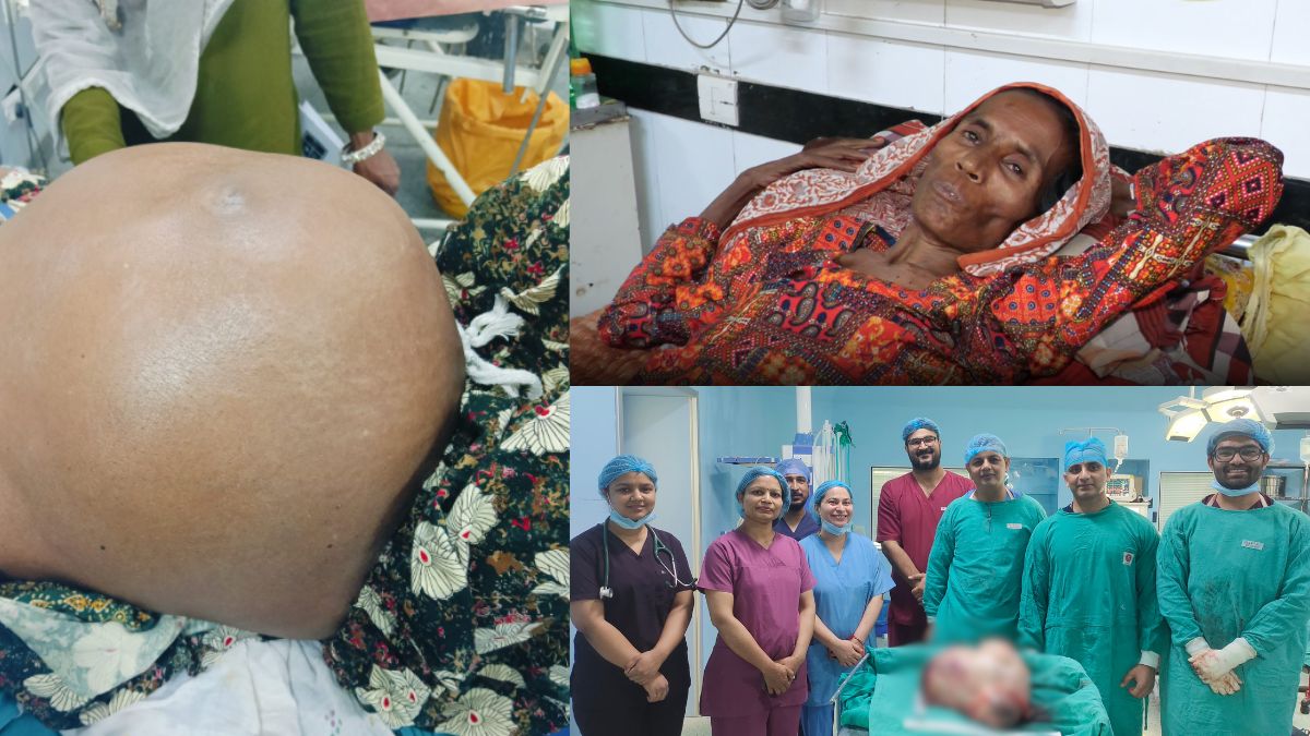 70 साल की महिला के पेट से निकला करीब 10 किलो का ट्यूमर, ऑपरेशन के बाद मिली राहत