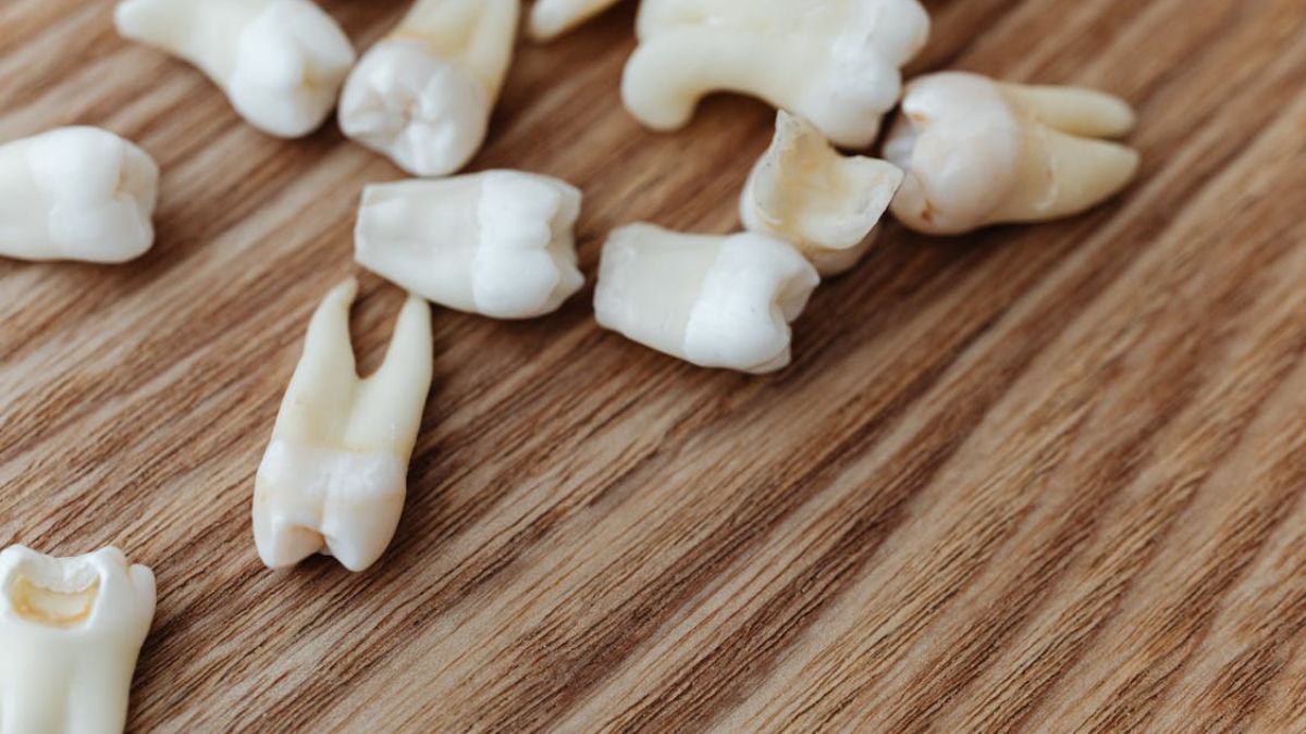 गलती से दांत निगलना पड़ा भारी, खाने की नली में फंसा; जानें कैसे मौत के मुंह से लौटा वापस