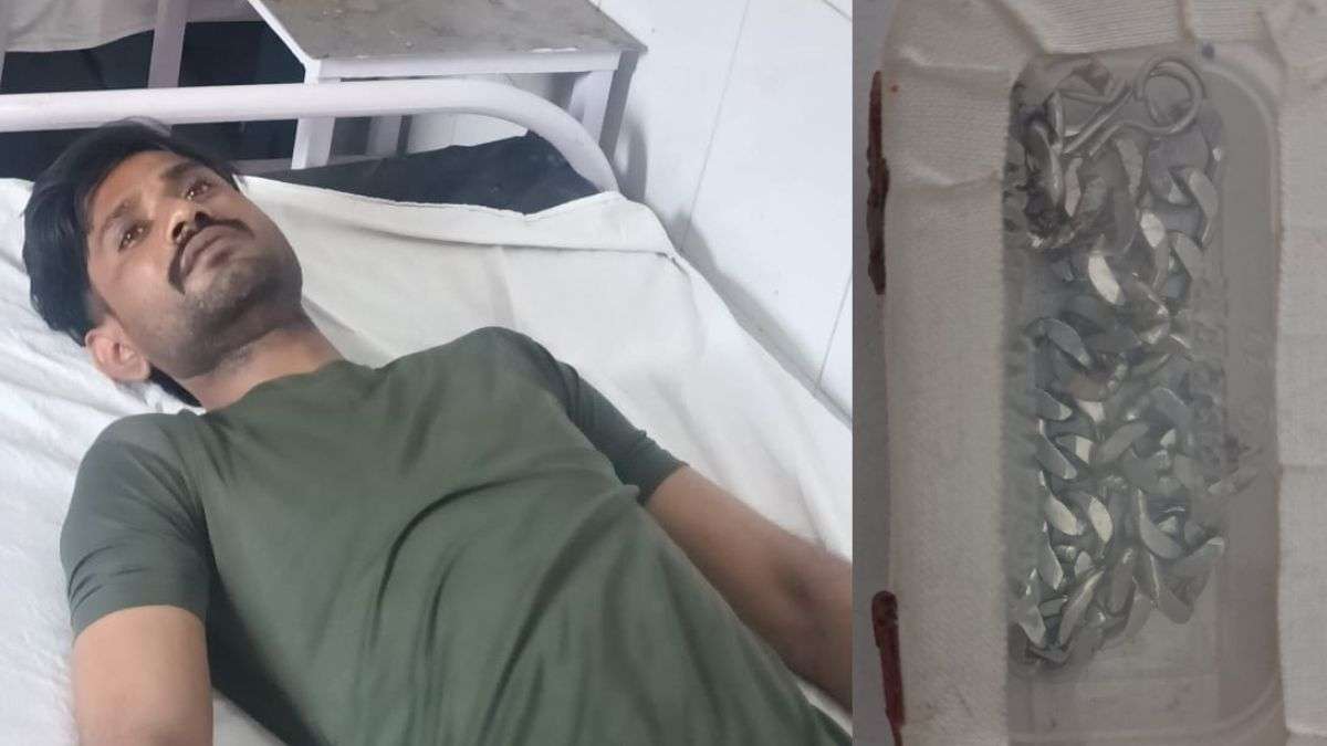 यूपी पुलिस ने 'मलद्वार' से निकलवा ली चांदी, चोरी के बाद निगल लिया था चोर; खिलानी पड़ी थी दवा