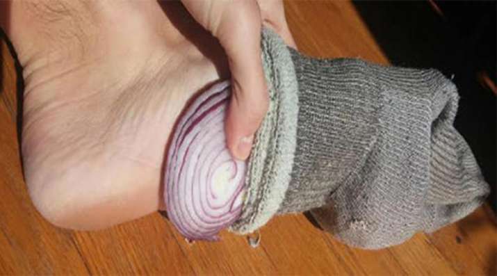 onion in socks onion in socks- India TV