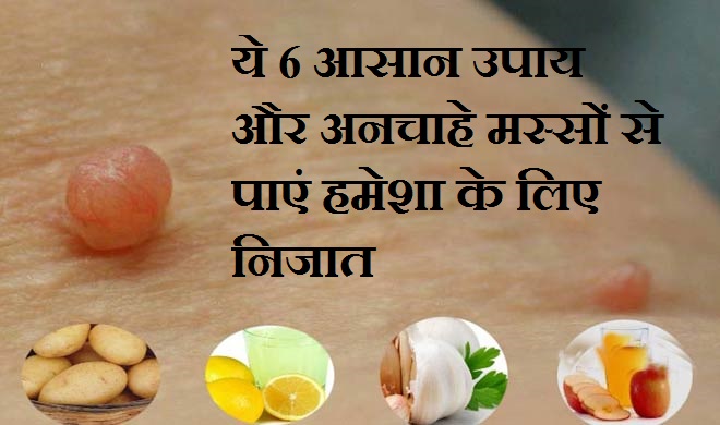 ये 6 आसान उपाय और... ये 6 आसान उपाय और...- India TV