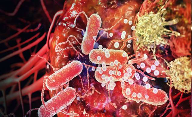 cancer cancer- India TV