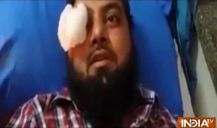 Kasganj-Violence-Muslim-youth-Akram-says-Hindus-saved-his-life-watch-video Kasganj-Violence-Muslim-youth-Akram-says-Hindus-saved-his-life-watch-video- India TV