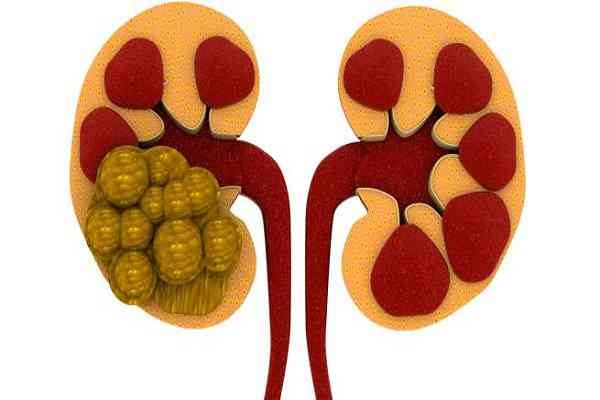kidney kidney- India TV