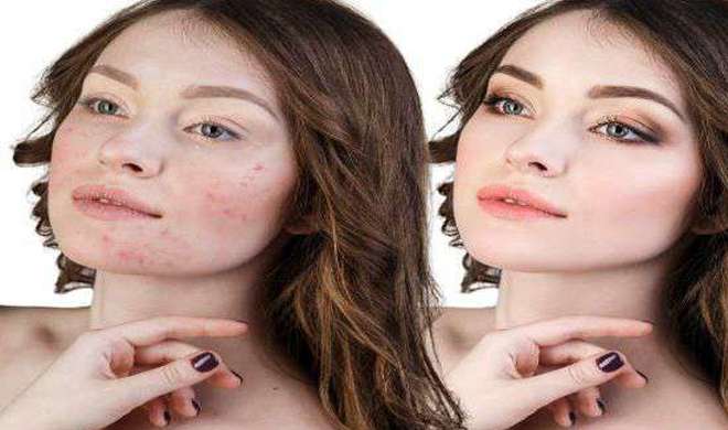 skin care skin care- India TV