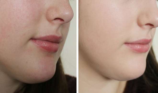 skin care skin care- India TV
