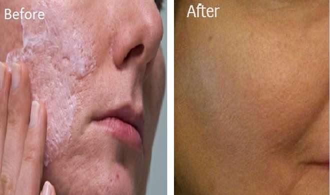 skin problem skin problem- Khabar IndiaTV