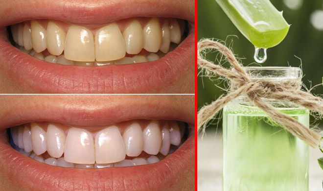aloe vera use for white teeth aloe vera use for white teeth- India TV