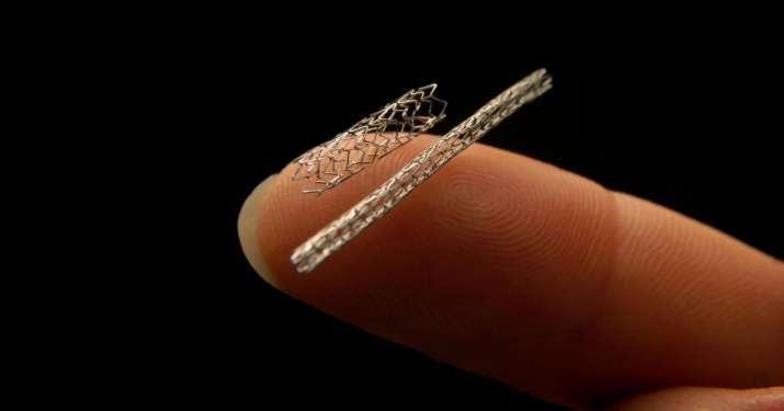 stents price by NPAA stents price by NPAA - IndiaTV Paisa