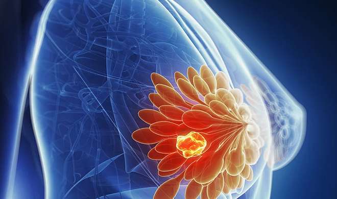 breast cancer breast cancer- India TV