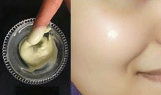 dark spot remove remedy dark spot remove remedy- India TV