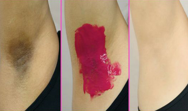 Apply this pink cream on your underarms Apply this pink cream on your underarms- India TV