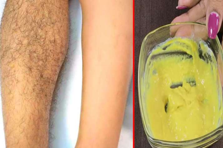 unwanted hair remover unwanted hair remover- India TV