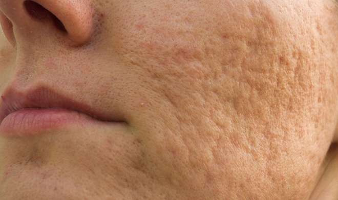 skin pores skin pores- Khabar IndiaTV
