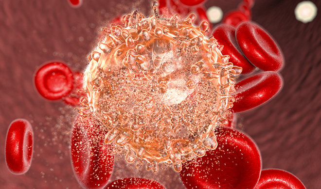 What Is Brain Cancer In Hindi - Brain Tumor Cancer