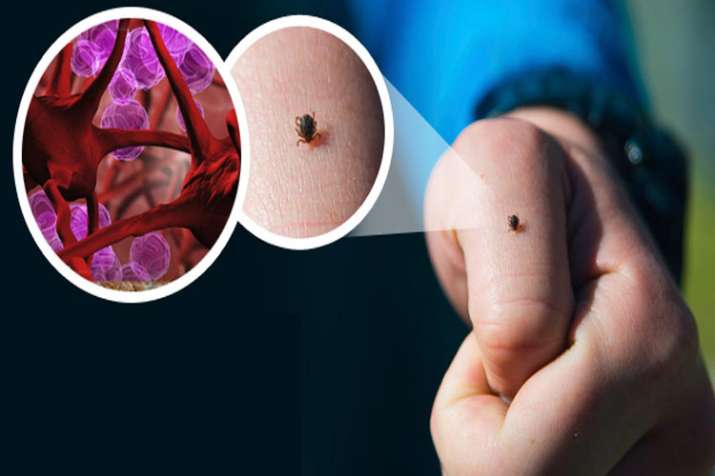 Japanese Encephalitis Japanese Encephalitis- Khabar IndiaTV