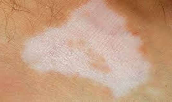 skin care skin care- India TV