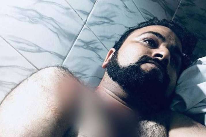 kafeel khan brother was attacked by unknowns- Khabar IndiaTV