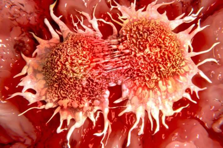 cancer cancer- India TV