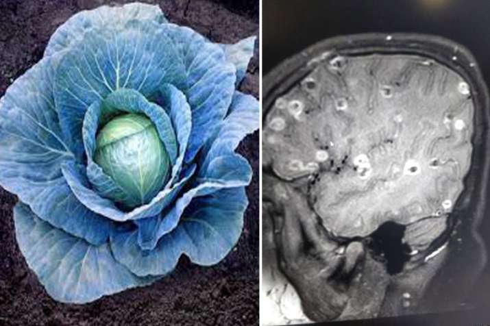 Cabbage Cabbage- India TV