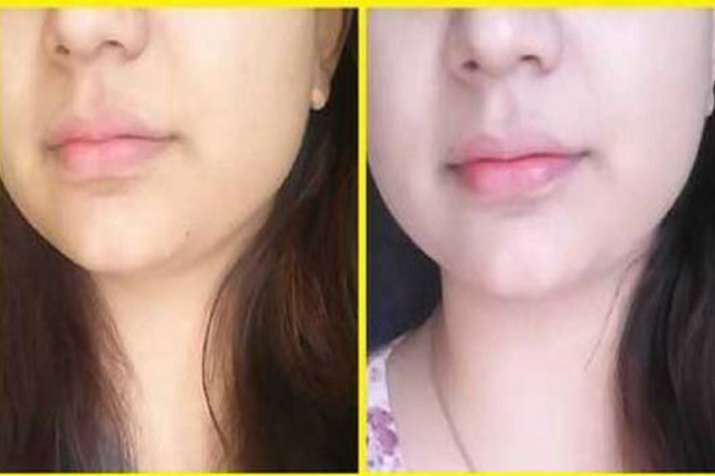 Fair Skin Fair Skin- India TV