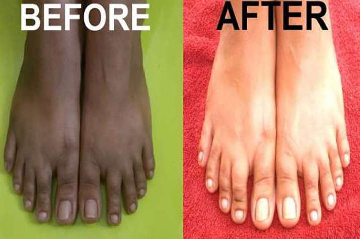 Feet Feet- India TV