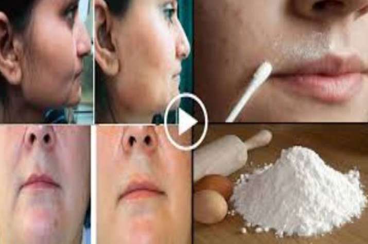 unwanted hair unwanted hair- India TV