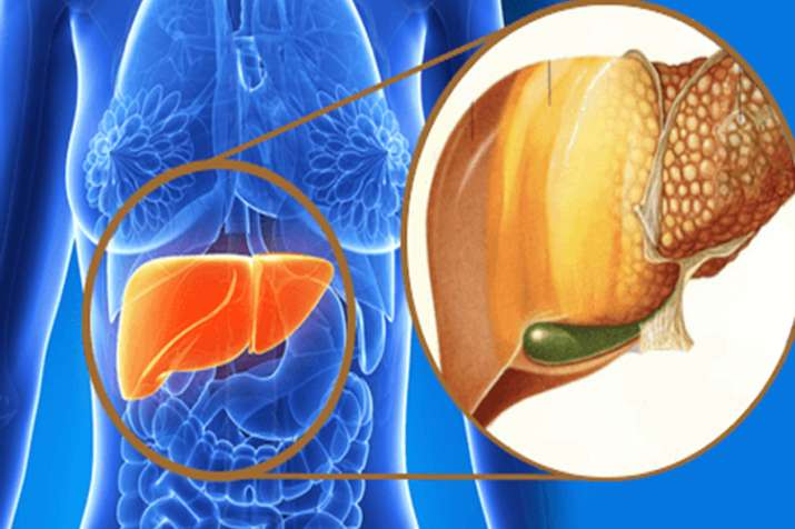 fatty liver fatty liver- India TV
