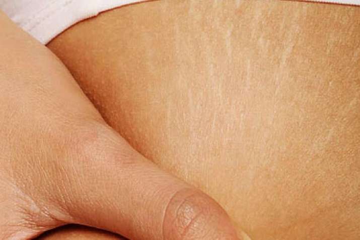 skin care tips skin care tips- India TV