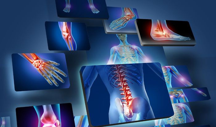 World Arthritis Day 2018 World Arthritis Day 2018- India TV