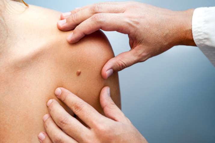 skin care tips skin care tips- India TV