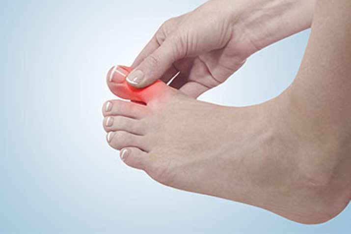 uric acid uric acid- India TV