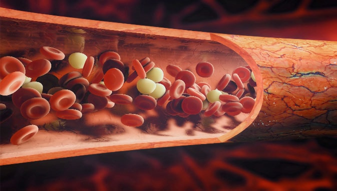 thalassemia thalassemia - India TV