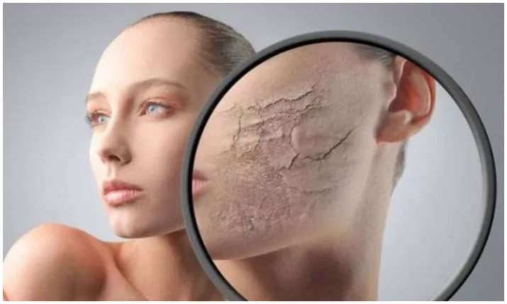 Dry and dull skin Dry and dull skin- India TV