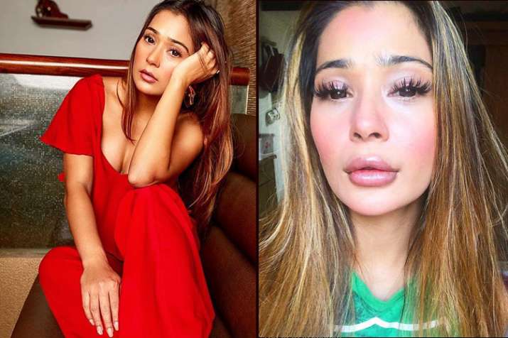 sara khan lip surgery sara khan lip surgery- India TV
