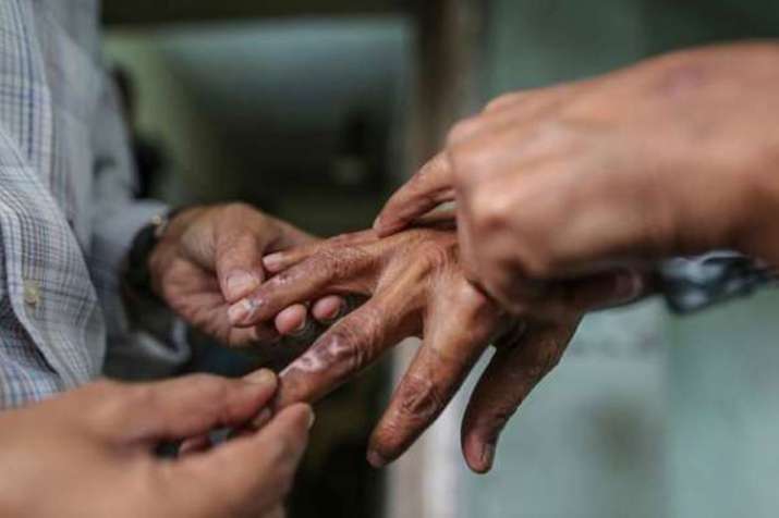 leprosy leprosy - India TV