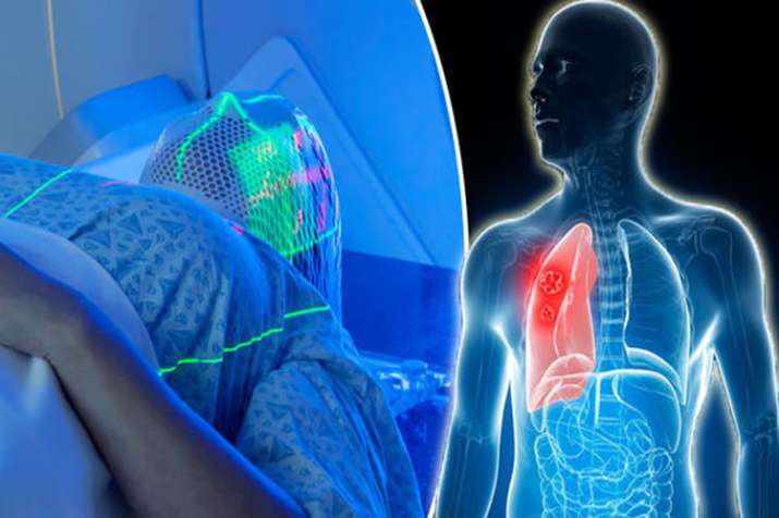 lungs cancer lungs cancer- India TV