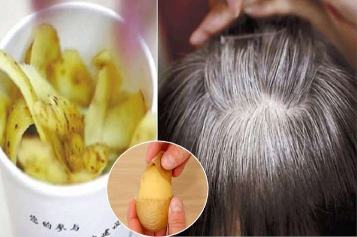 potato hair tips potato hair tips- India TV