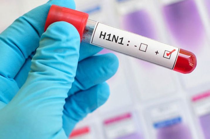 Swine Flu Swine Flu- India TV