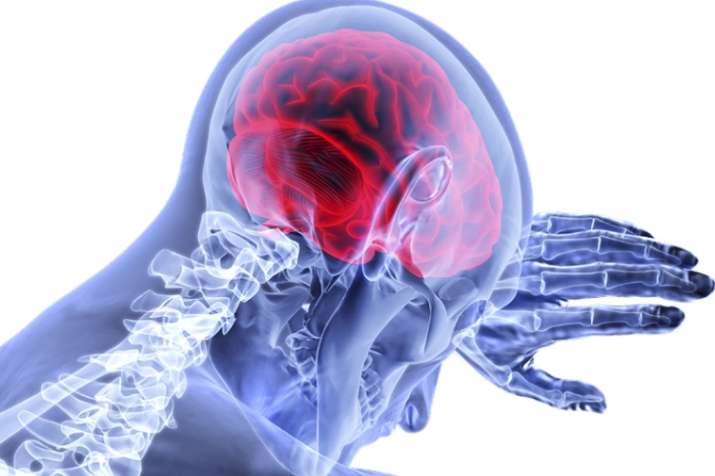 brain-hemorrhage-symptoms-causes-survival-rate-treatment-in-hinid