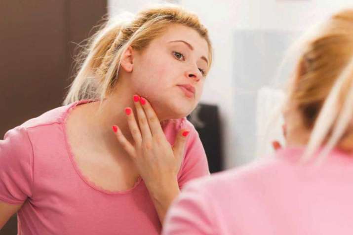 vitamin c deficiency vitamin c deficiency- India TV