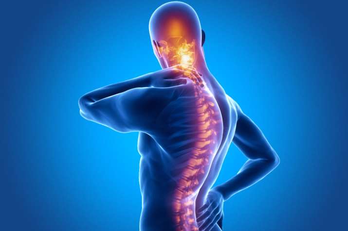 Ankylosing Spondylitis Ankylosing Spondylitis- India TV