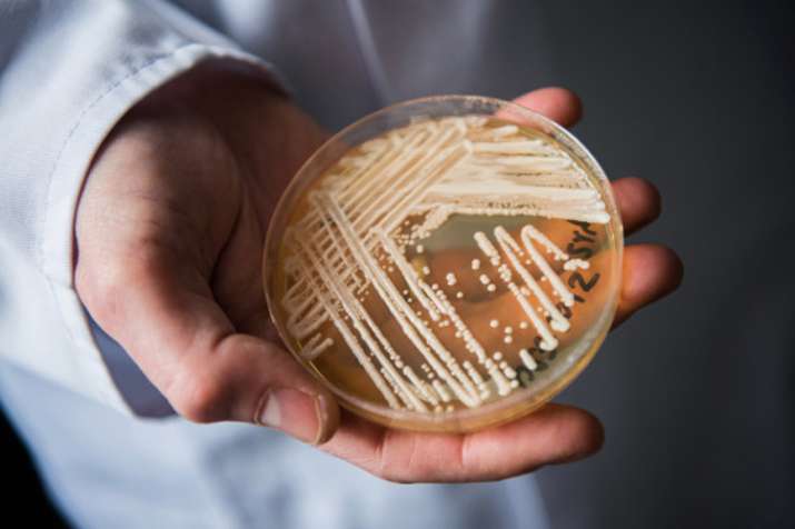 candida auris candida auris- India TV