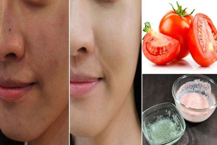 skin care tips skin care tips- India TV