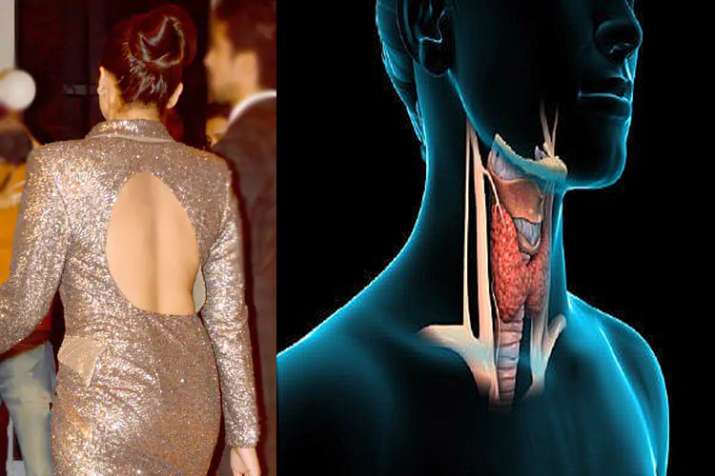 health problem health problem- India TV