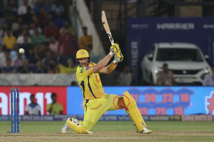 खून से लथपथ घुटने के बावजूद चेन्नई को खिताबी जीत दिलाने में लगे रहे शेन वॉट्सन, अब लगे 6 टांके खून से लथपथ घुटने के बावजूद चेन्नई को खिताबी जीत दिलाने में लगे रहे शेन वॉट्सन, अब लगे 6 टांके- India TV