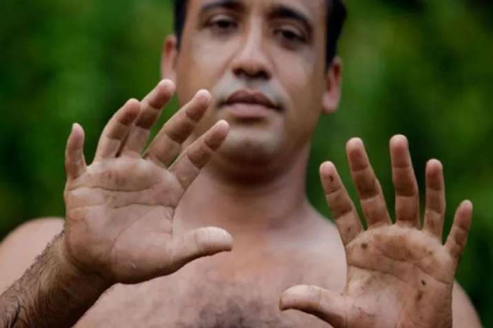 6 fingers per hand are better than 5 says research 6 fingers per hand are better than 5 says research - India TV